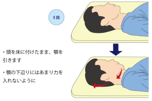 ストレートネック